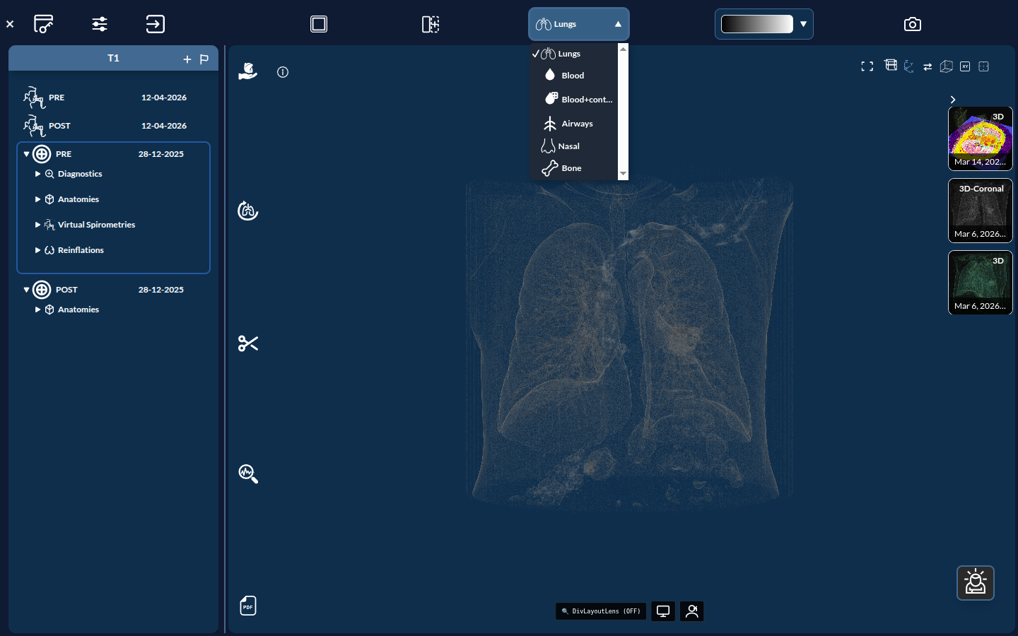 Image preset dropdown