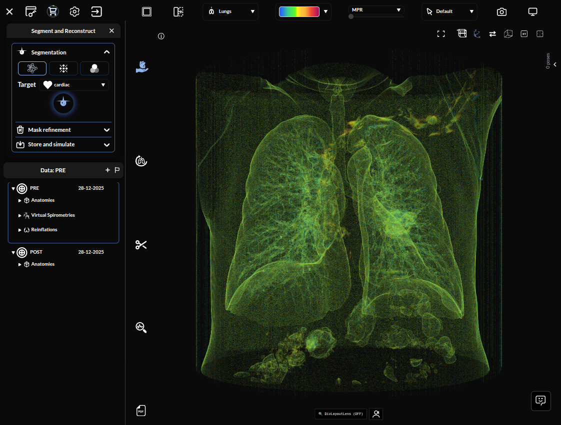 Segmentation panel with lung lobes overlaid