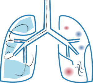 Functional lung reconstruction