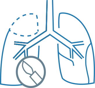 Pre-operative evaluation