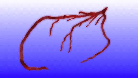 Cardiovascular