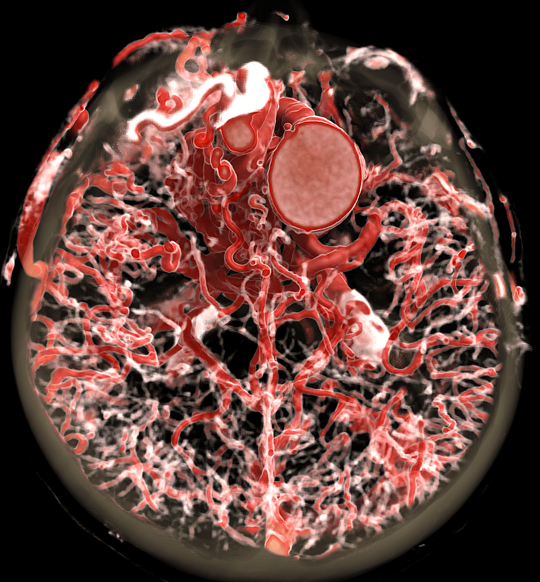 Anatomical reconstruction from imaging